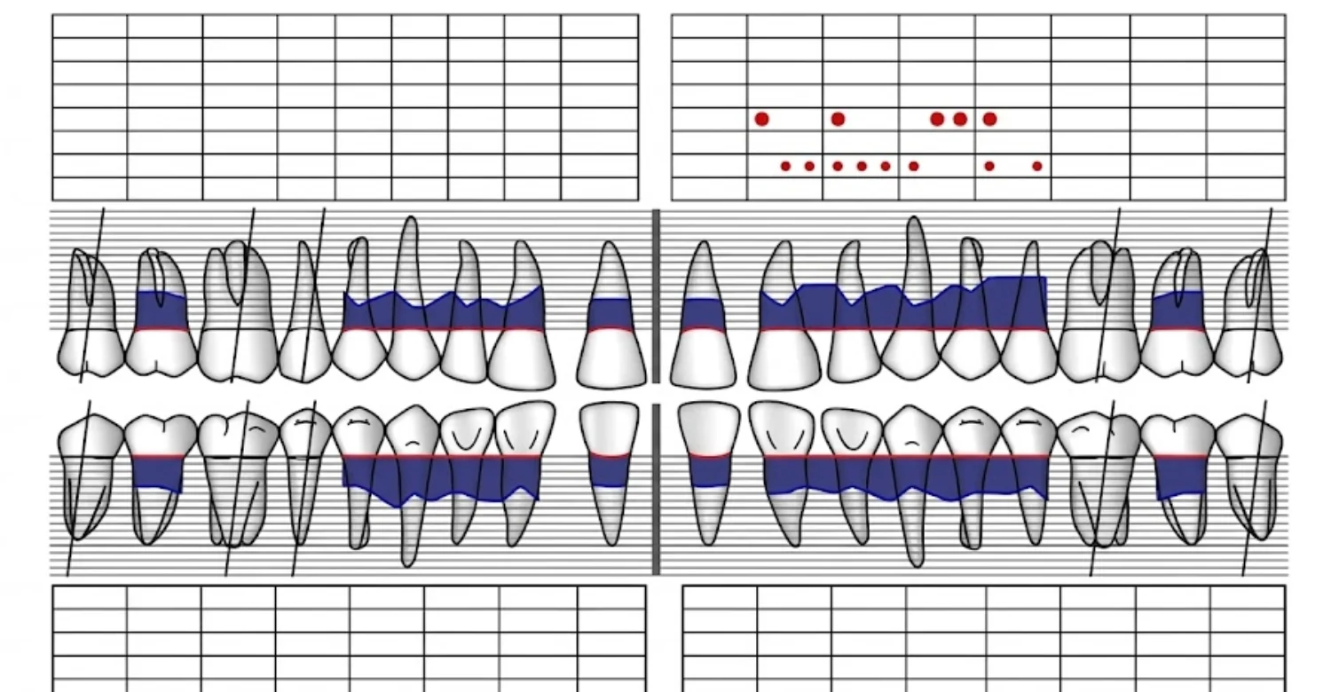 Dental and Periodontal Charting 2